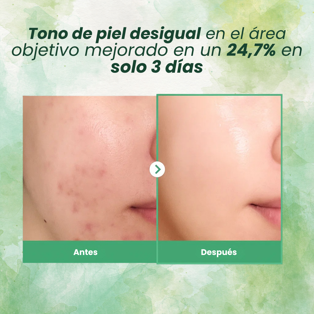 Dermalift™: El Secreto de una Piel Joven al Dormir.
